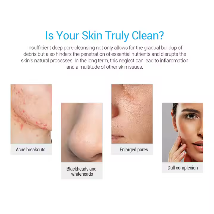 Newest 5 in 1 Hydra Aqua Peel Facial Dermabrasion Deep Cleaning Beauty Machine for Salon